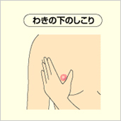 わきの下のしこり